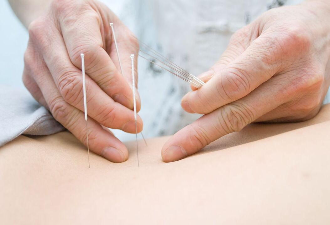The doctor places needles