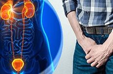 Symptoms of prostatitis